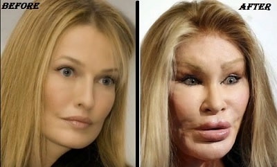 A picture of Jocelyn Wildenstein before (left) and after (right).